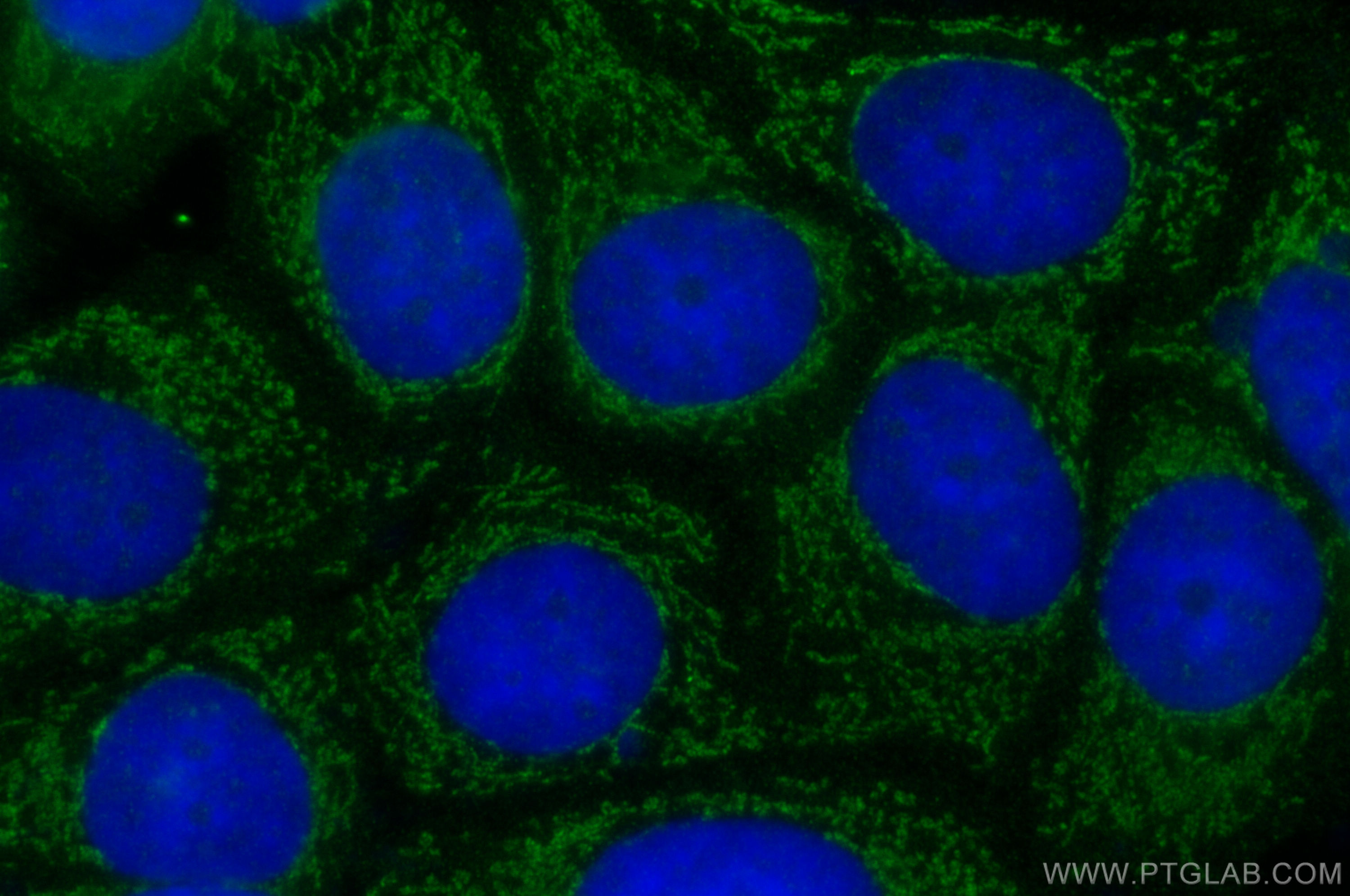 IF Staining of MCF-7 using 31147-1-AP