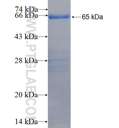 NRIP1 fusion protein Ag26585 SDS-PAGE