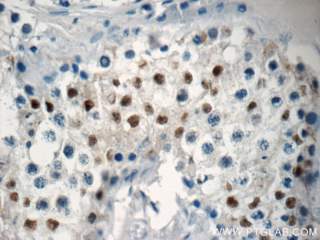 IHC staining of human testis using 23955-1-AP