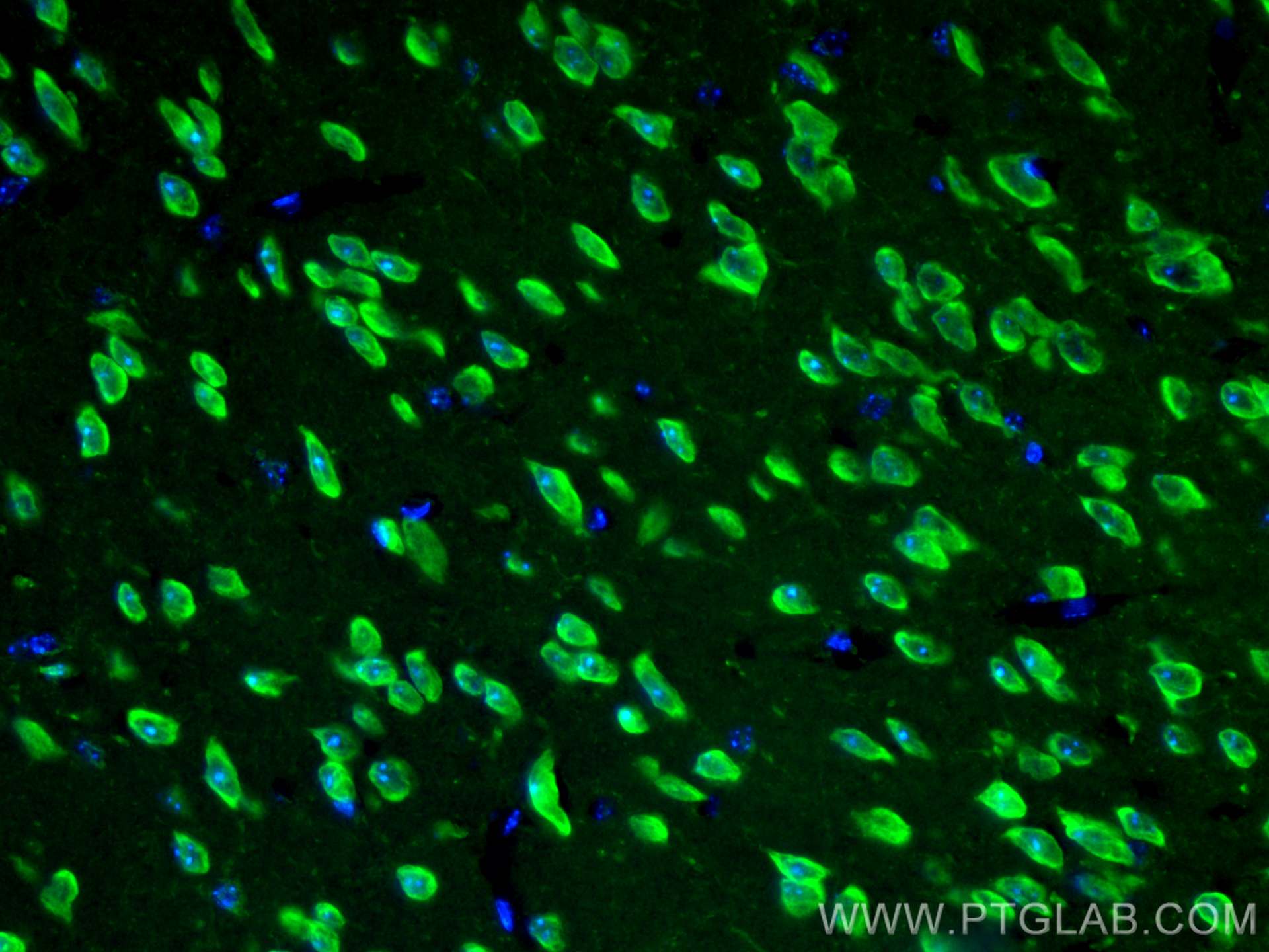 IF Staining of mouse brain using CL488-66150
