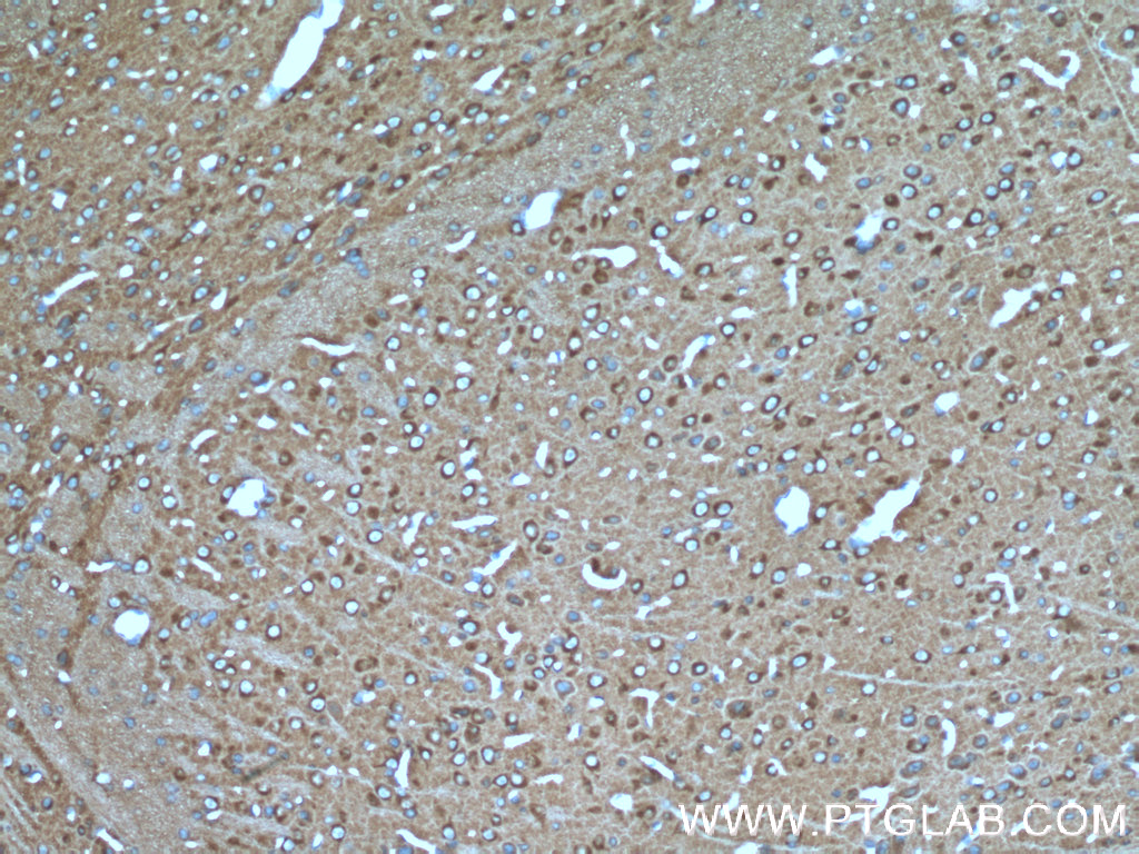 IHC staining of mouse brain using 21172-1-AP