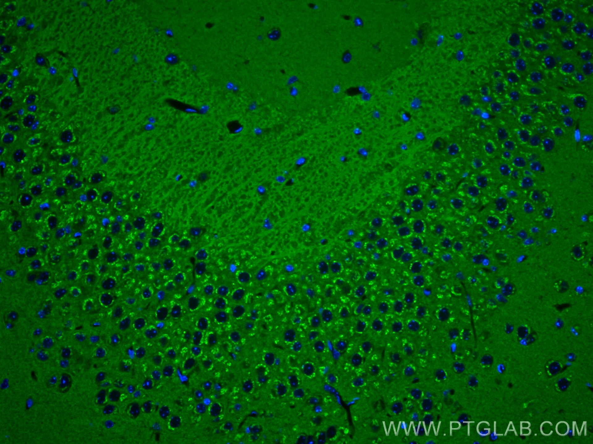 IF Staining of mouse brain using 68061-1-Ig (same clone as 68061-1-PBS)