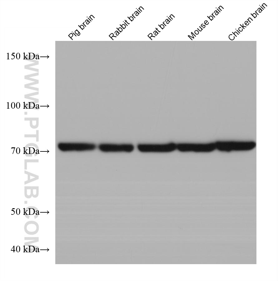 WB analysis using 68061-1-Ig (same clone as 68061-1-PBS)