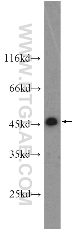 WB analysis of A431 using 15620-1-AP