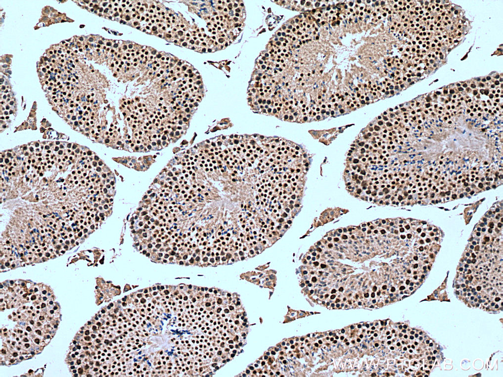 IHC staining of mouse testis using 13627-1-AP