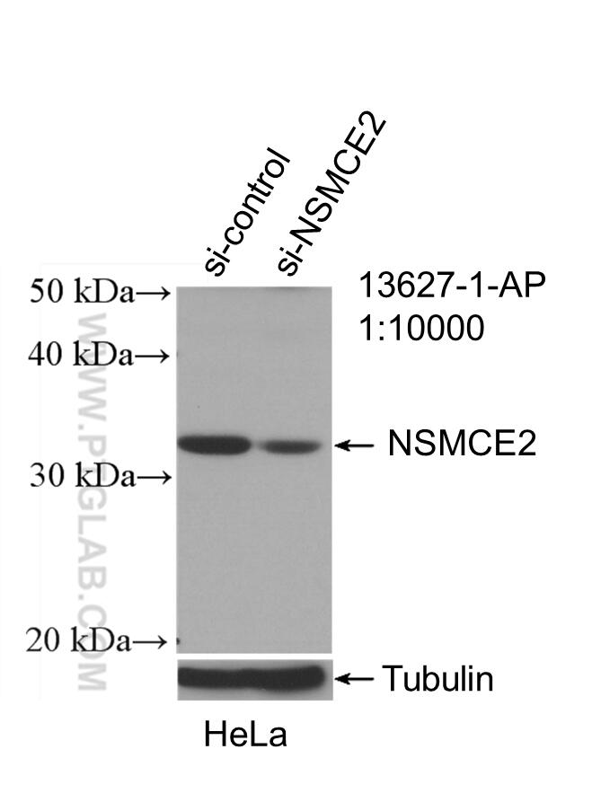 WB analysis of HeLa using 13627-1-AP