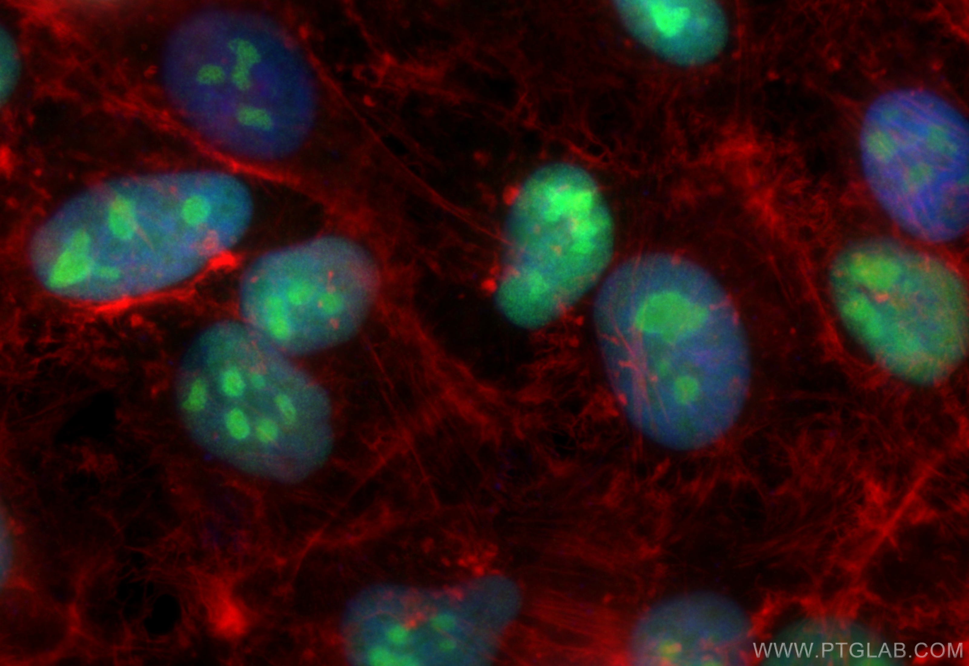 IF Staining of HeLa using 82894-2-RR (same clone as 82894-2-PBS)