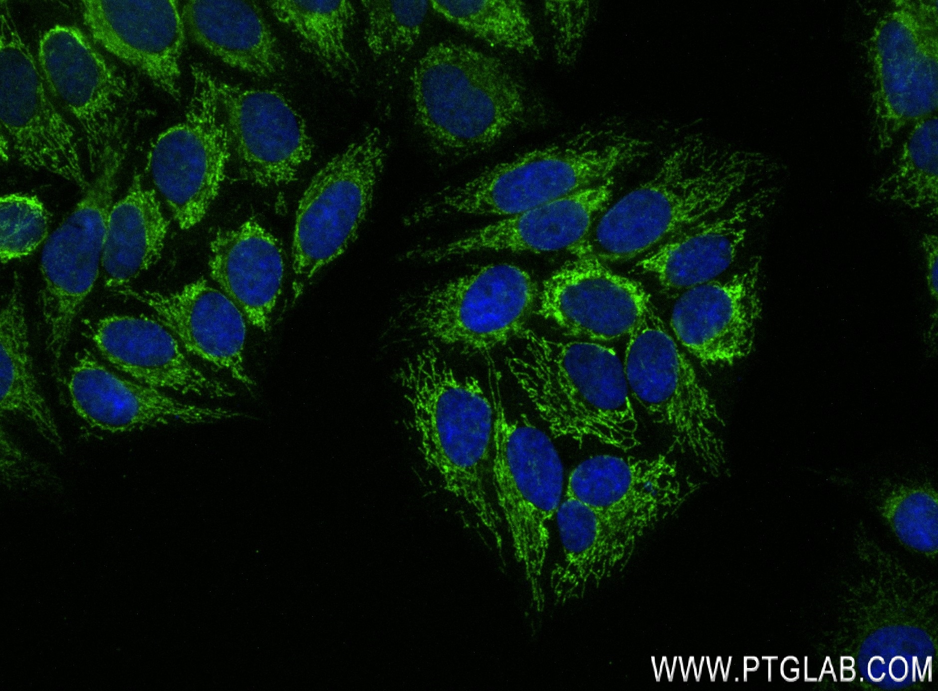 IF Staining of HepG2 using 84275-3-RR (same clone as 84275-3-PBS)