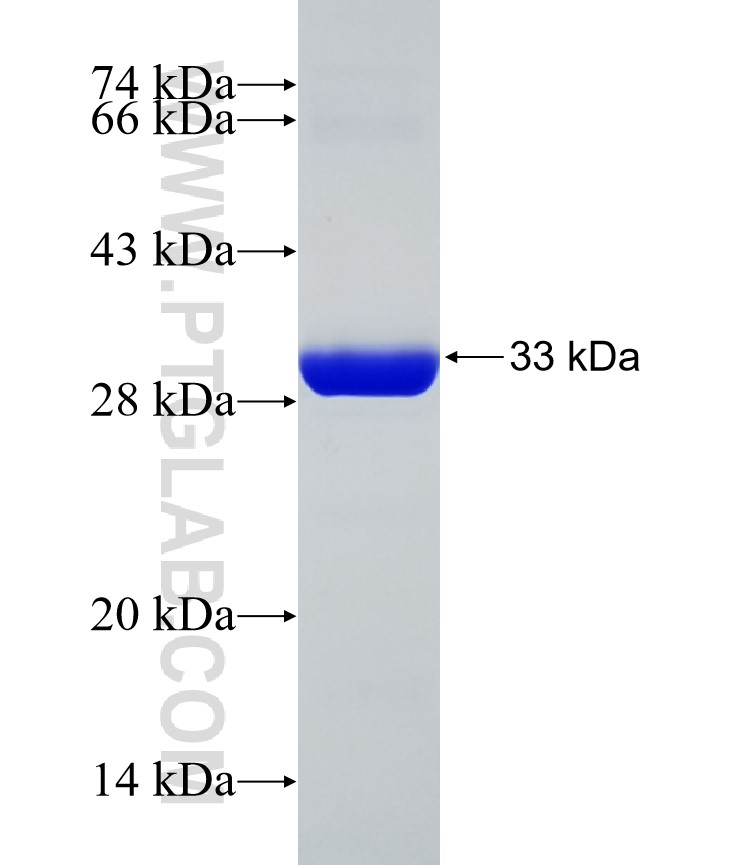 NSUN4 fusion protein Ag31828 SDS-PAGE