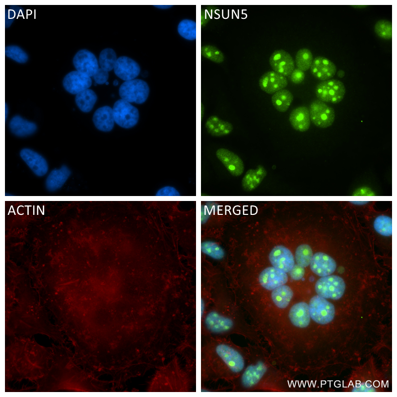 IF Staining of HeLa using 84768-2-RR (same clone as 84768-2-PBS)