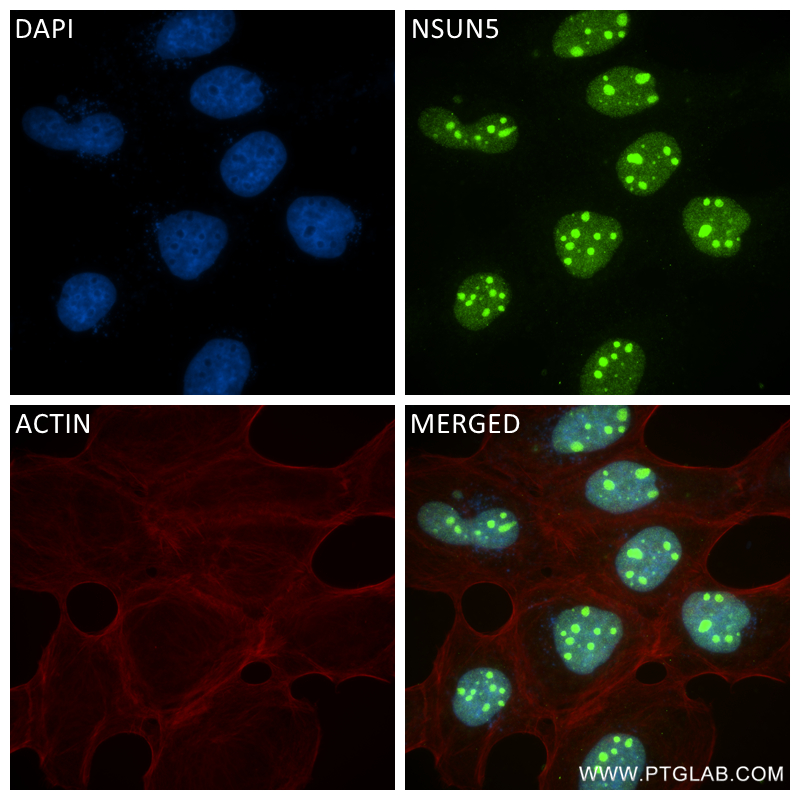 IF Staining of A431 using 84768-2-RR (same clone as 84768-2-PBS)