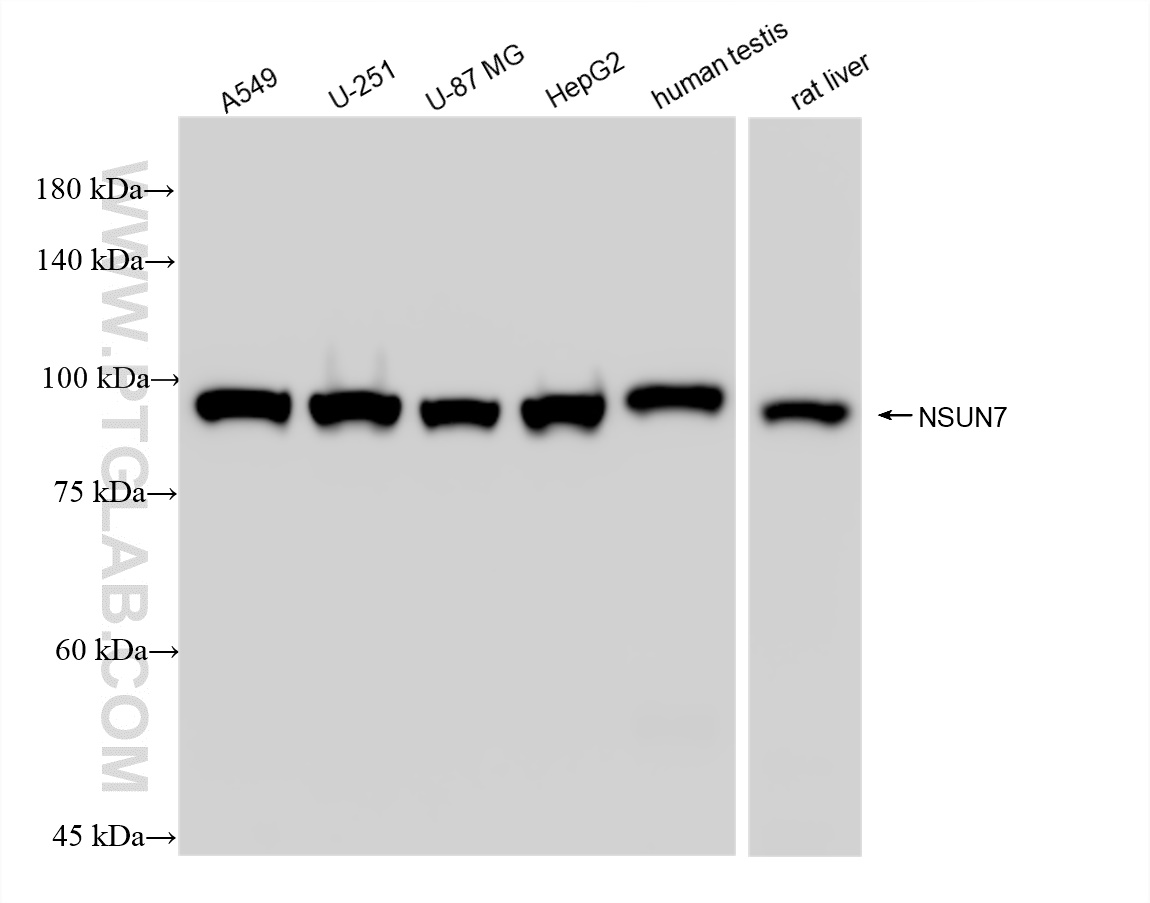 WB analysis using 84795-1-RR (same clone as 84795-1-PBS)