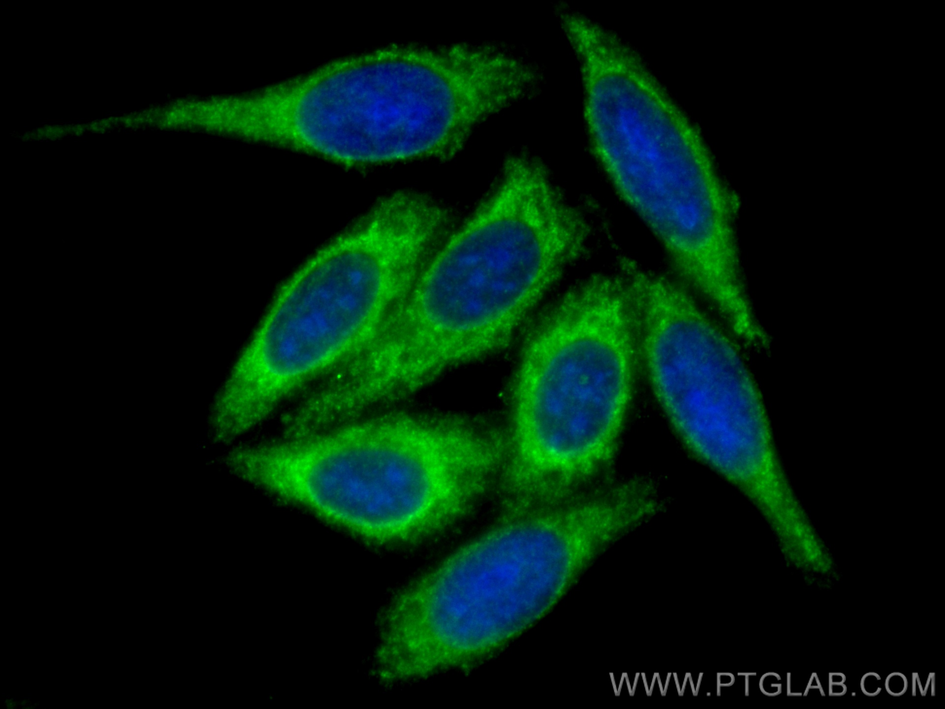 IF Staining of HepG2 using 15223-1-AP