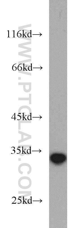 WB analysis of human skeletal muscle using 11393-1-AP