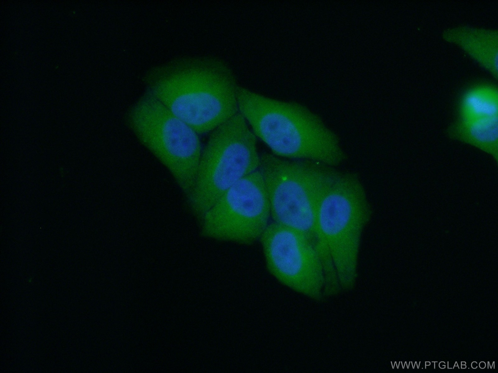 IF Staining of HepG2 using 24102-1-AP