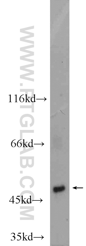 WB analysis of MCF-7 using 24102-1-AP