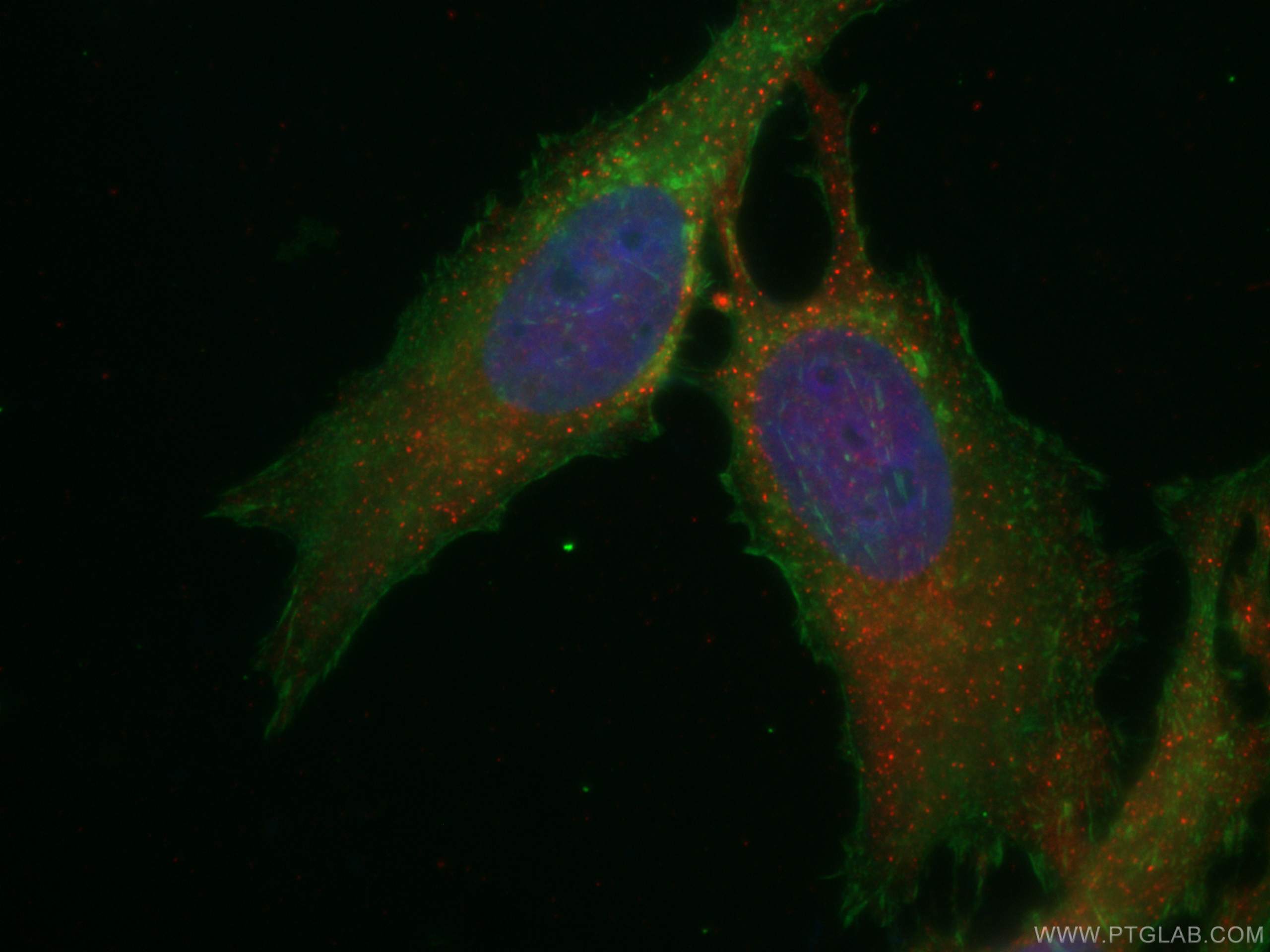 IF Staining of HeLa using CL594-66063