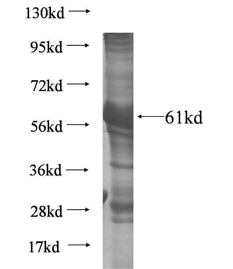 NTM fusion protein Ag5746 SDS-PAGE