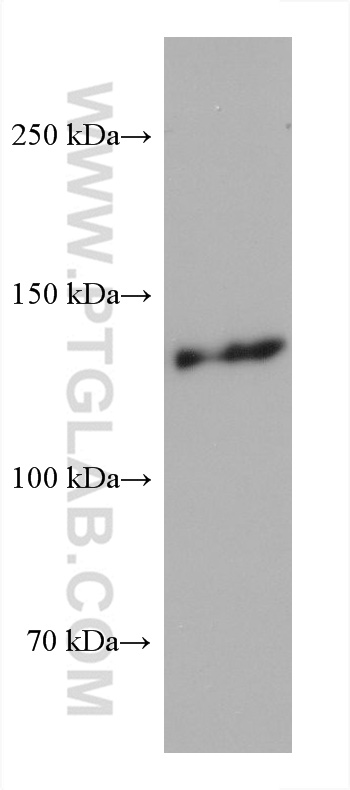 WB analysis of NK-92 using 60548-1-Ig (same clone as 60548-1-PBS)