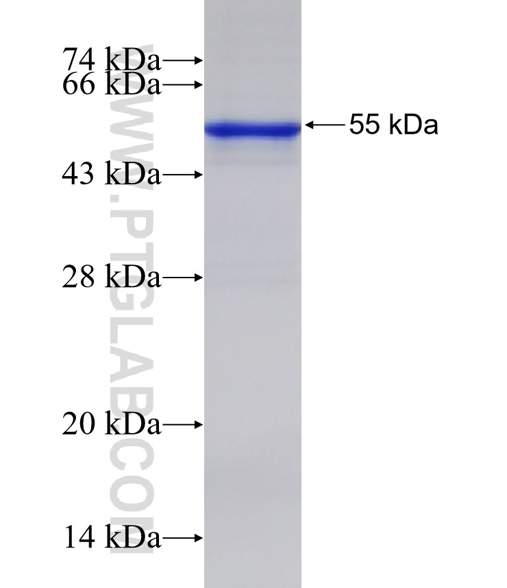 NTRK1 fusion protein Ag32759 SDS-PAGE