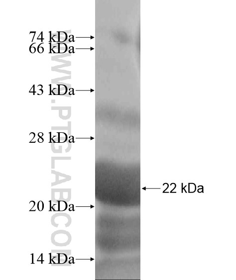 NUAK1 fusion protein Ag18832 SDS-PAGE