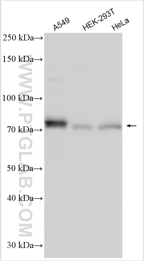 WB analysis using 31718-1-AP