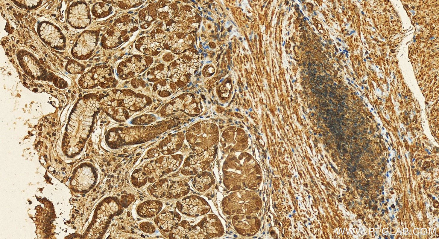 IHC staining of human stomach using 18011-1-AP