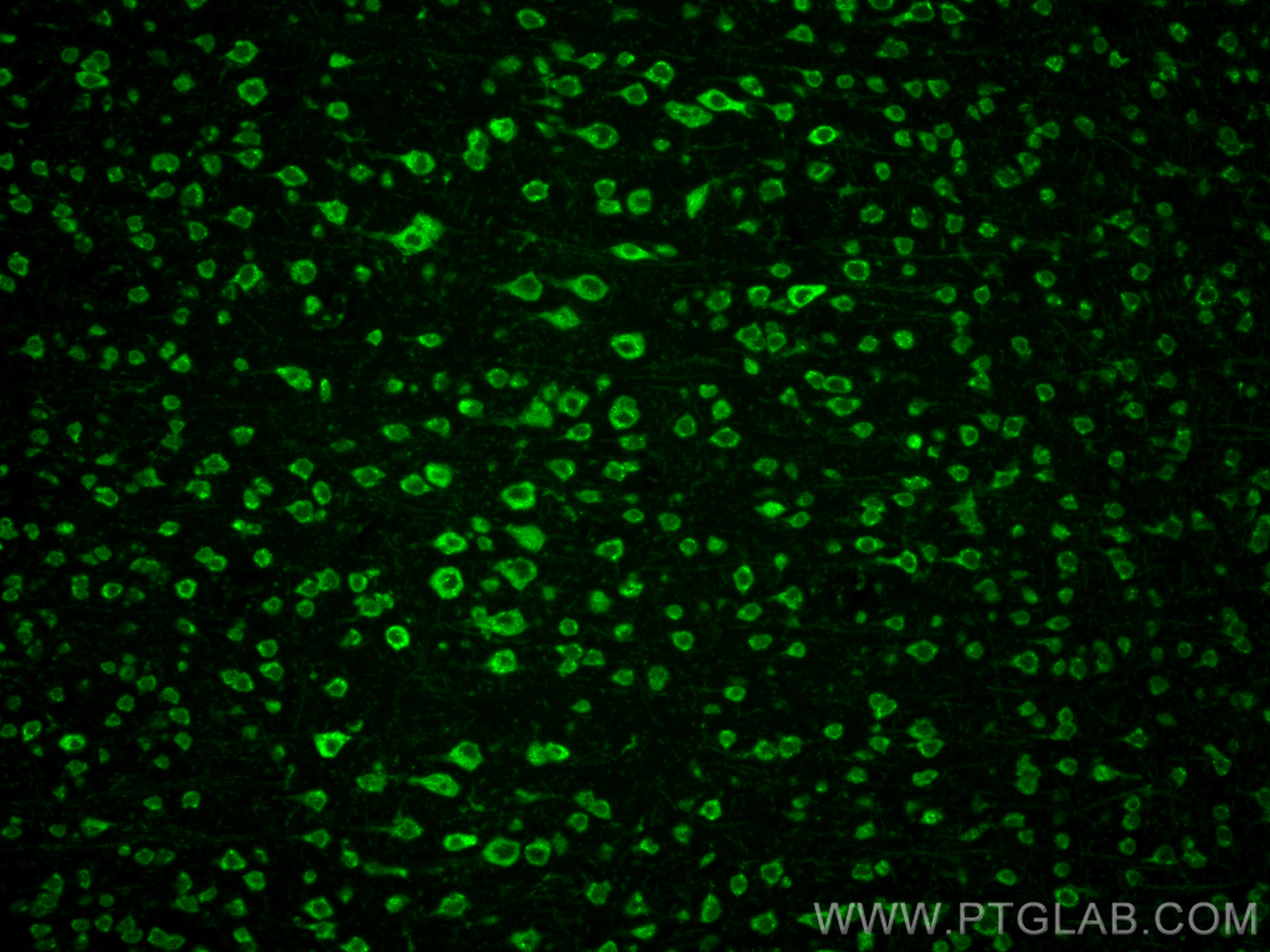 IF Staining of mouse brain using 10228-1-AP