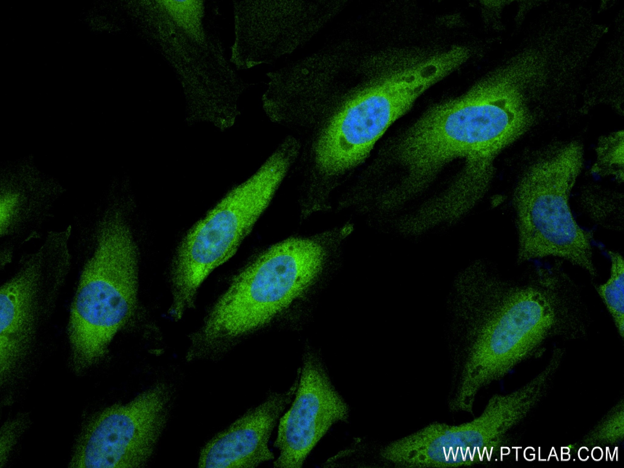 IF Staining of HepG2 using 83917-5-RR (same clone as 83917-5-PBS)