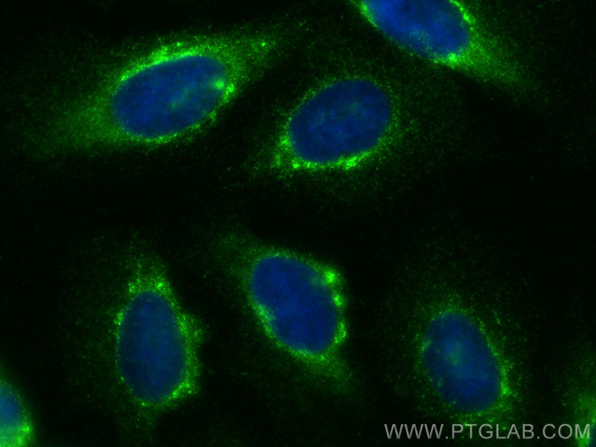 IF Staining of U2OS using 30604-1-AP