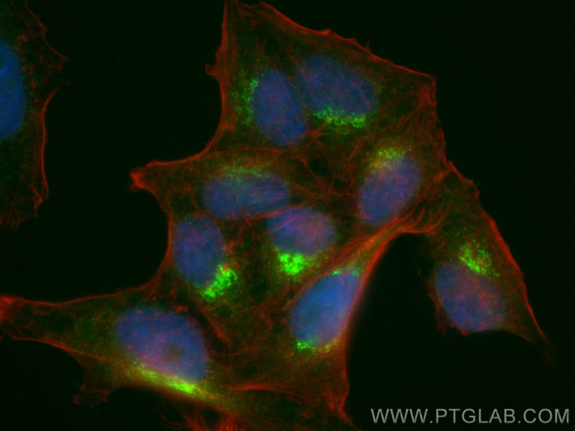 NUCB2/nesfatin-1