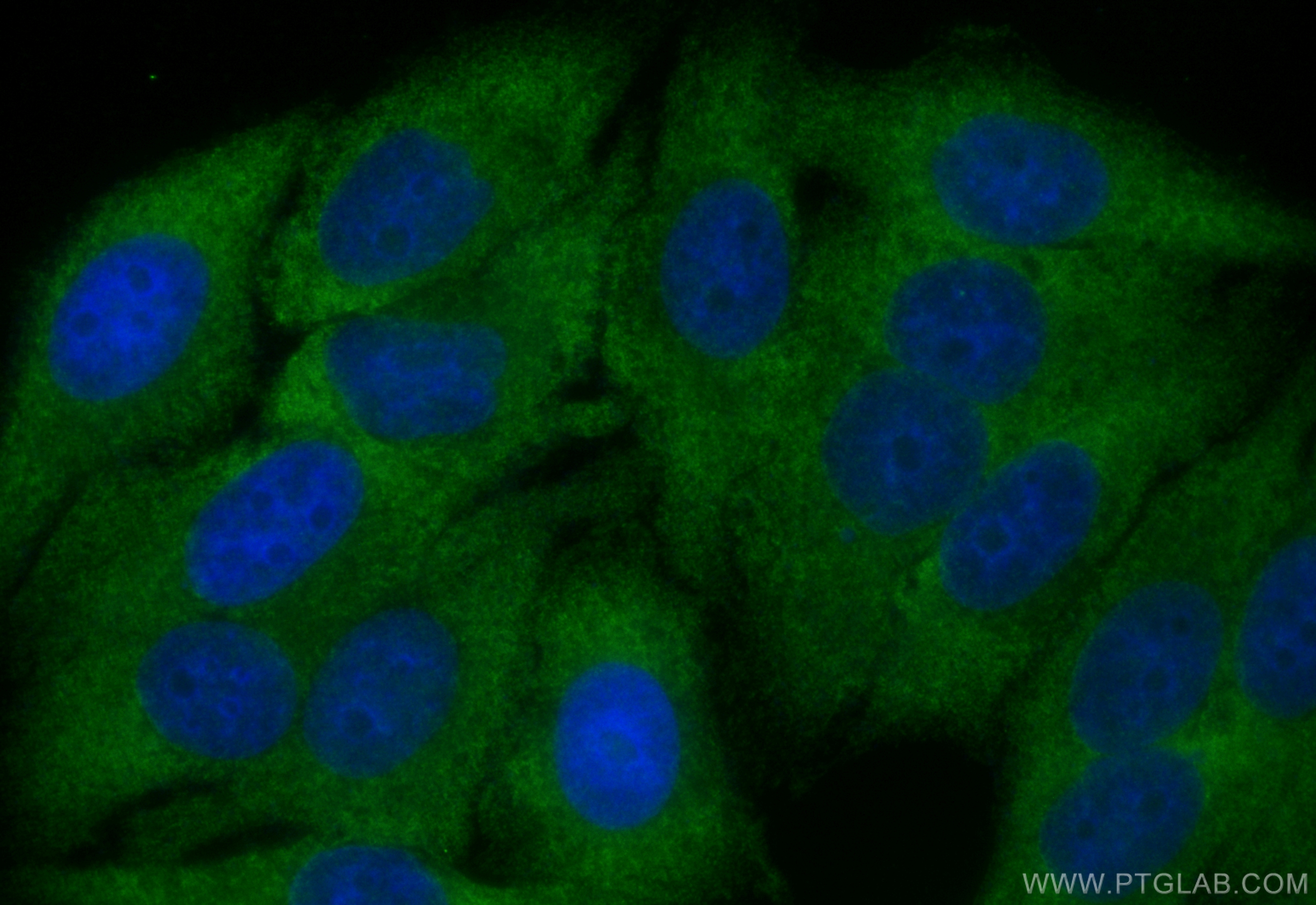 NUCB2/nesfatin-1