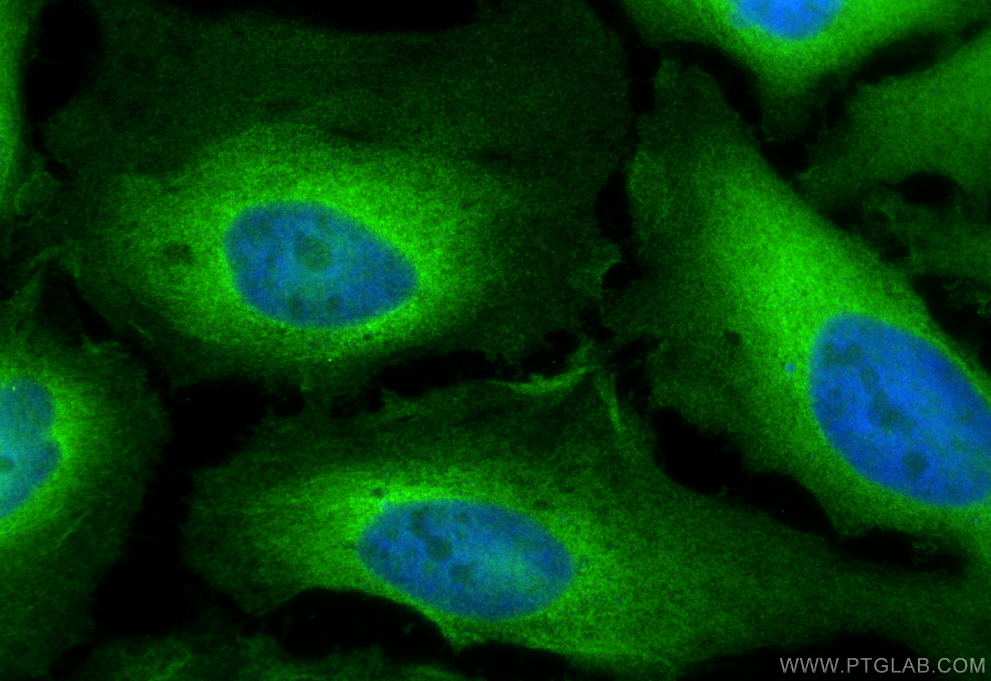 IF Staining of HeLa using 10681-1-AP