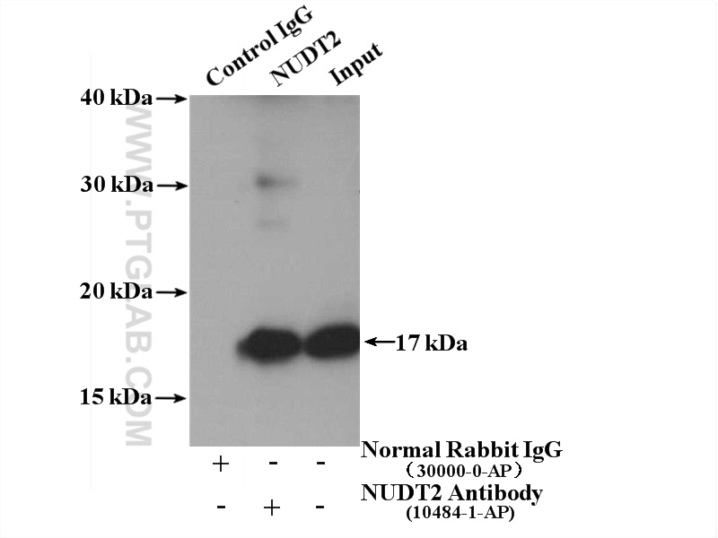 IP experiment of HEK-293 using 10484-1-AP