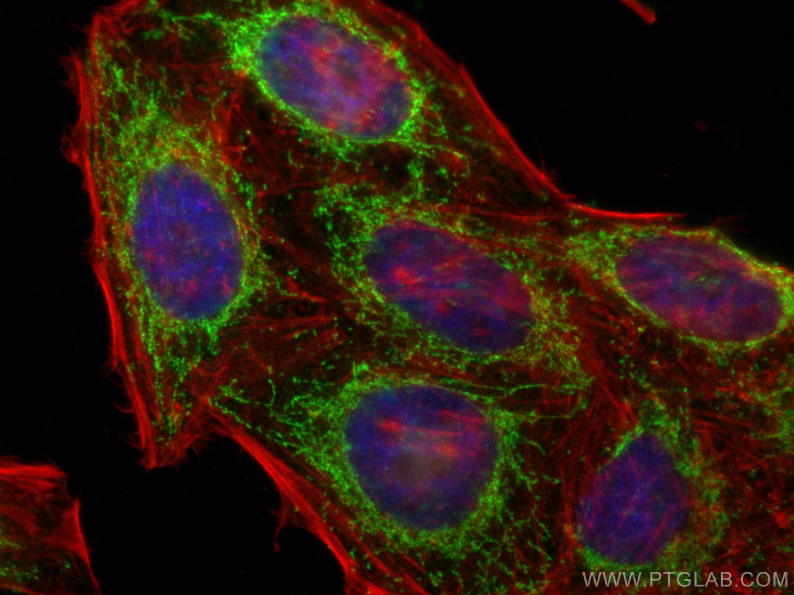 IF Staining of HepG2 using 11181-1-AP