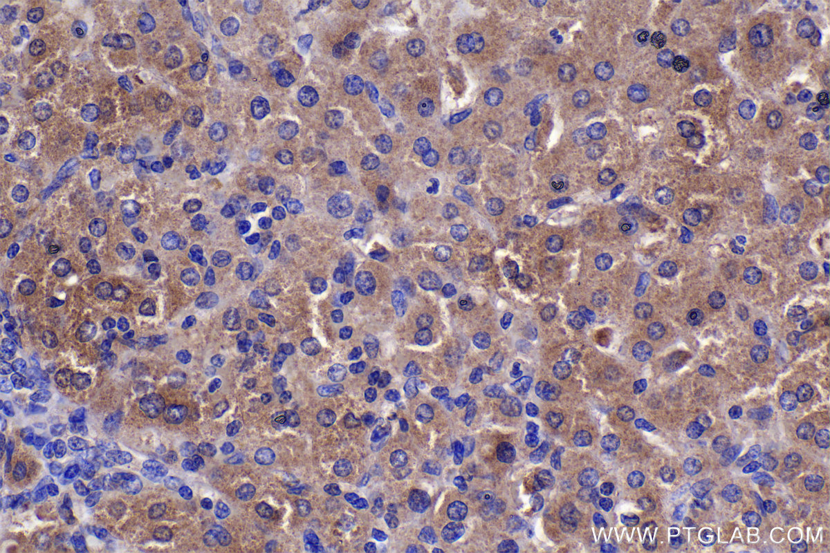 IHC staining of human liver using 11181-1-AP