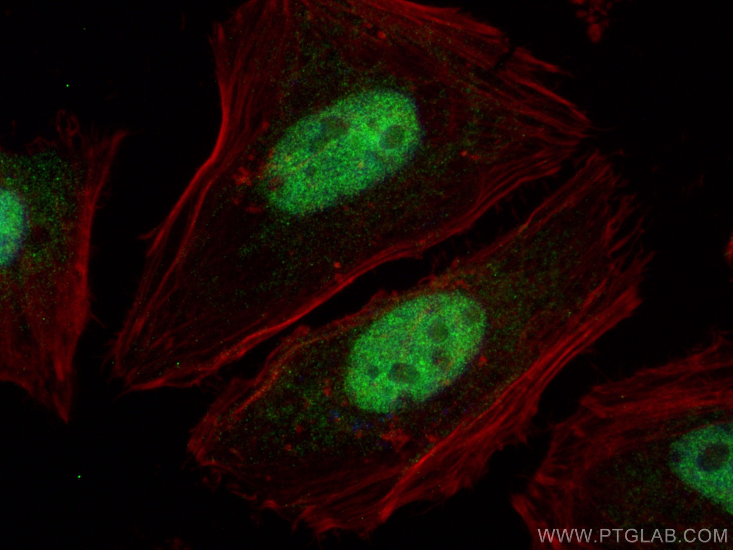 IF Staining of HeLa using 12515-1-AP