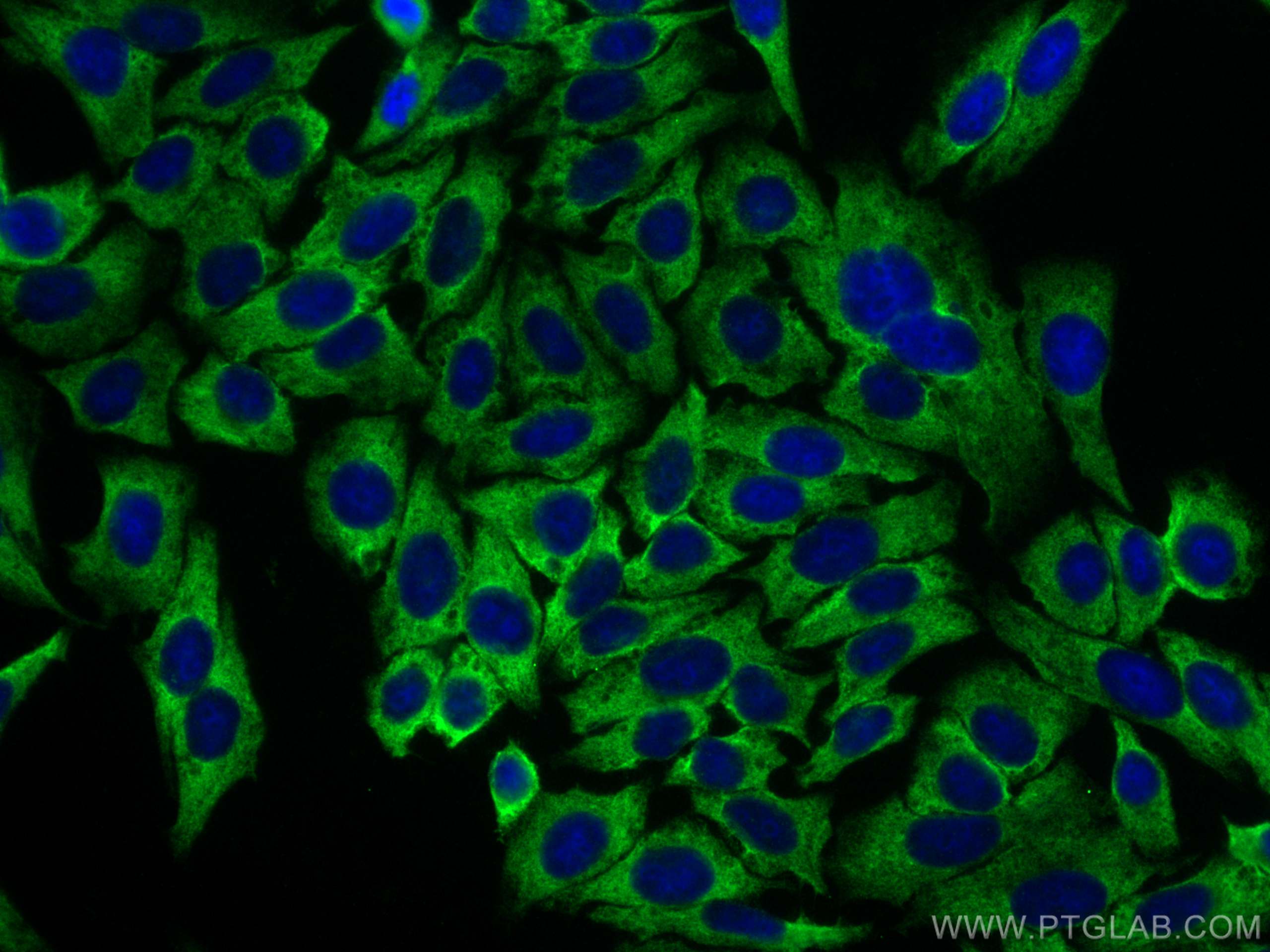 IF Staining of HepG2 using 17752-1-AP