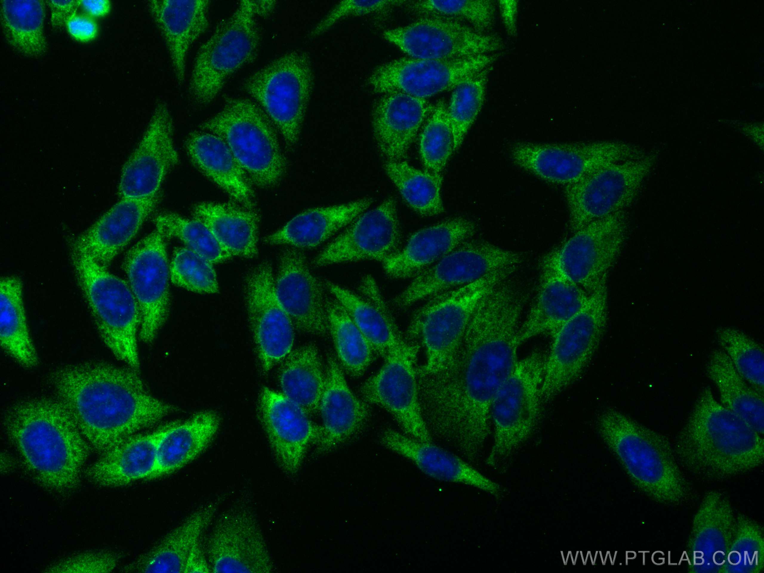 IF Staining of HepG2 using 67195-1-Ig