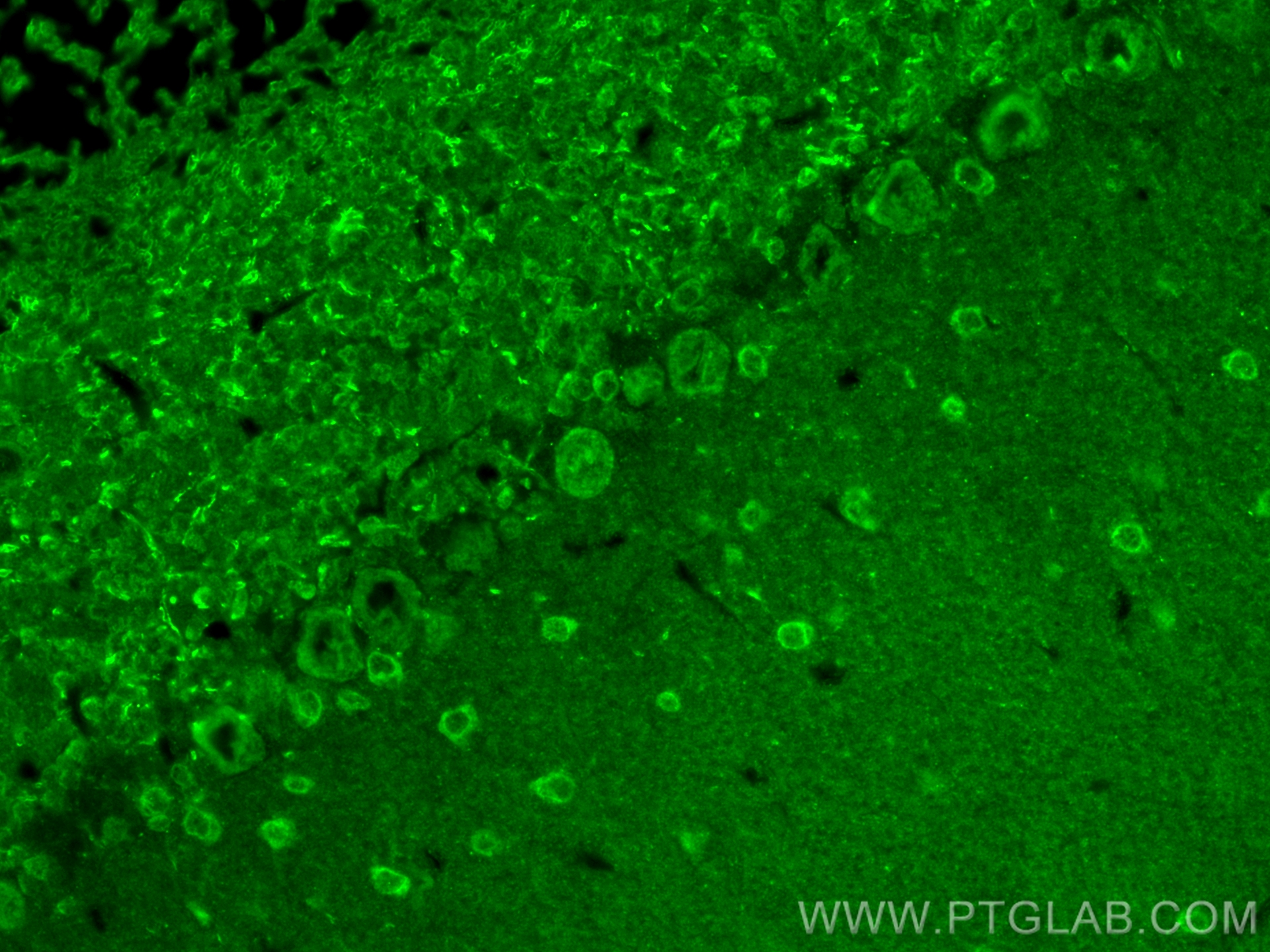 IF Staining of mouse cerebellum using 10111-1-AP