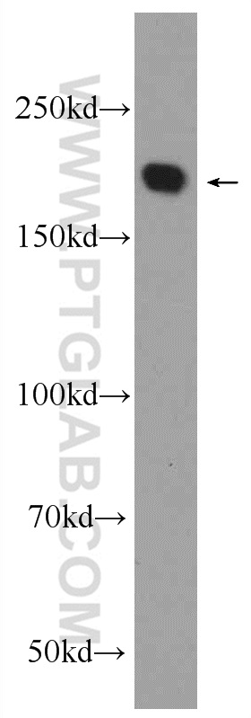 WB analysis of HeLa using 24439-1-AP