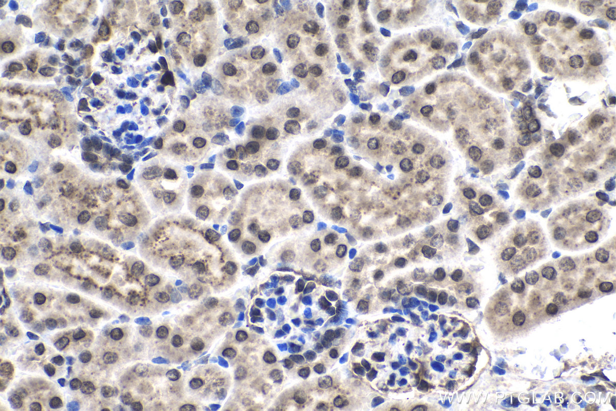 IHC staining of mouse kidney using 24113-1-AP