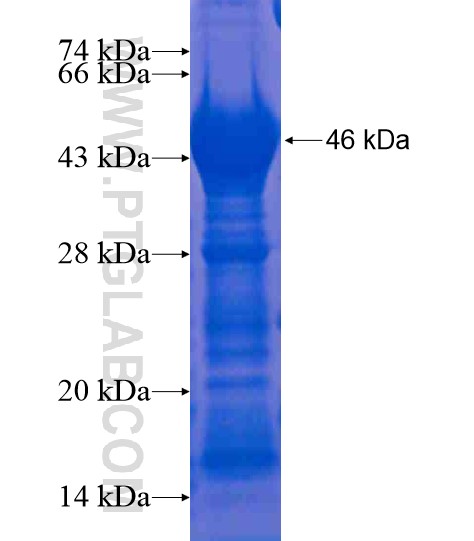 NUP214 fusion protein Ag21377 SDS-PAGE