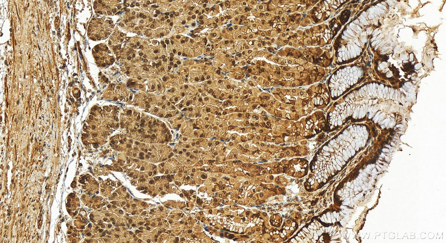 IHC staining of human stomach using 13916-1-AP