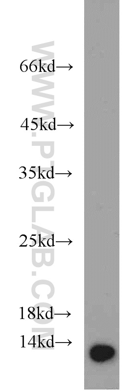 WB analysis of HeLa using 66063-1-Ig