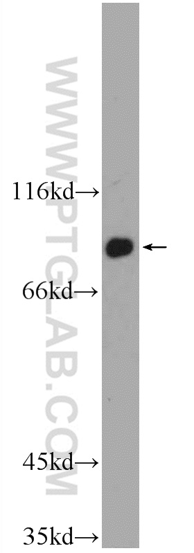 WB analysis of mouse brain using 25108-1-AP