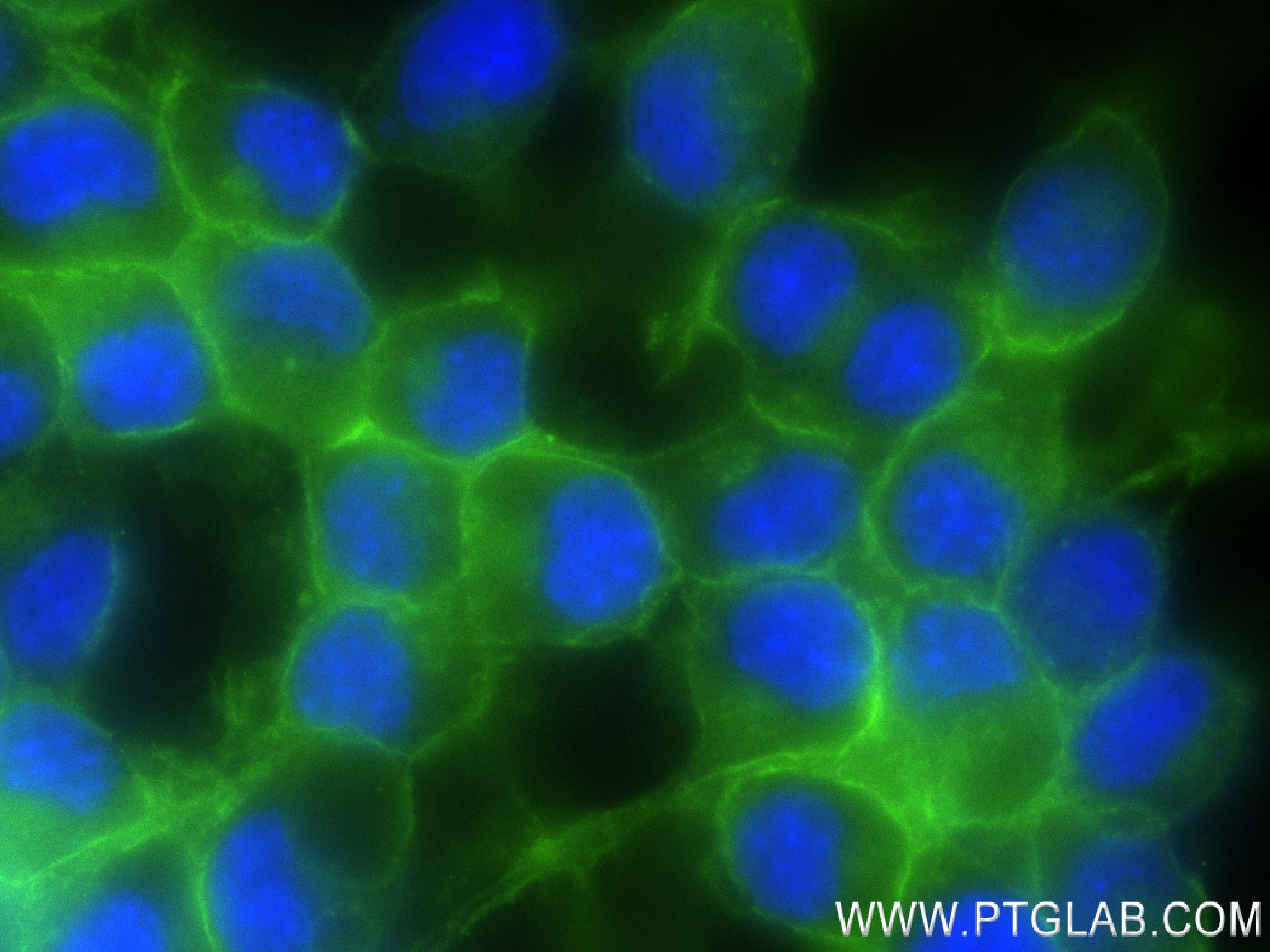 IF Staining of Neuro-2a using 83883-5-RR