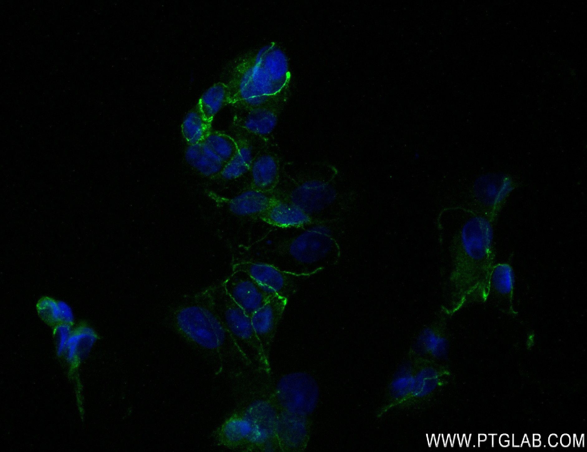 IF Staining of MCF-7 using 83223-4-RR (same clone as 83223-4-PBS)