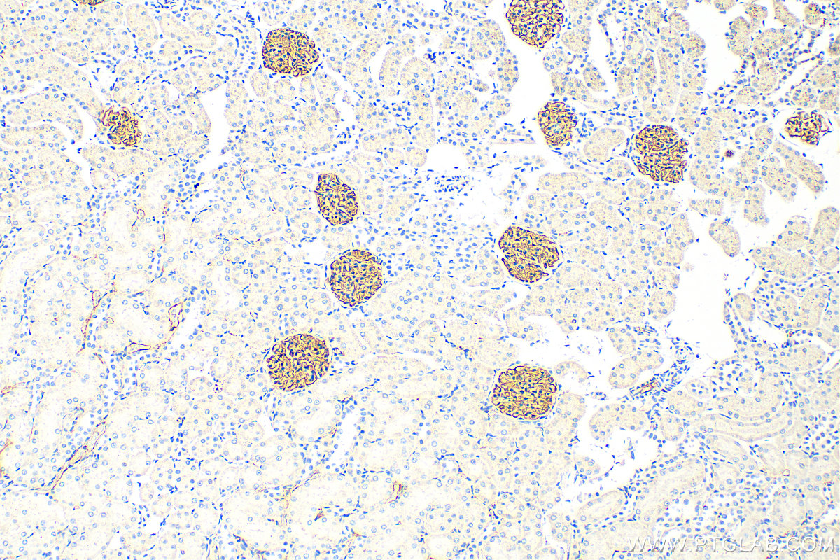 IHC staining of rat kidney using 22912-1-AP