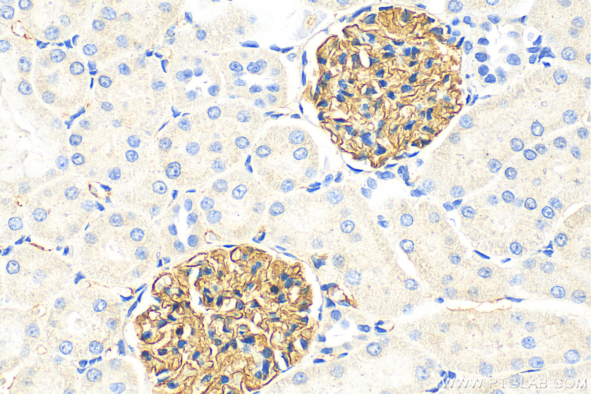 IHC staining of rat kidney using 22912-1-AP